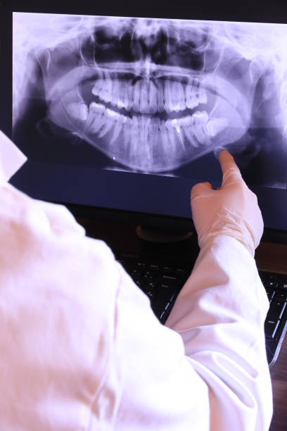 Best Knocked-Out Tooth (Avulsed Tooth) Treatment in Prineville Lake Acres, OR